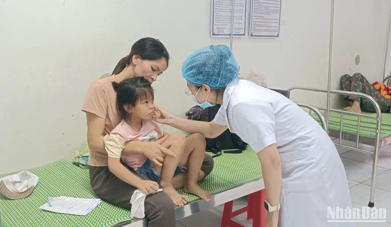 Một trường hợp trẻ em ở huyện Hưng Hà (tỉnh Thái Bình) phải điều trị nội trú do mắc đau mắt đỏ.