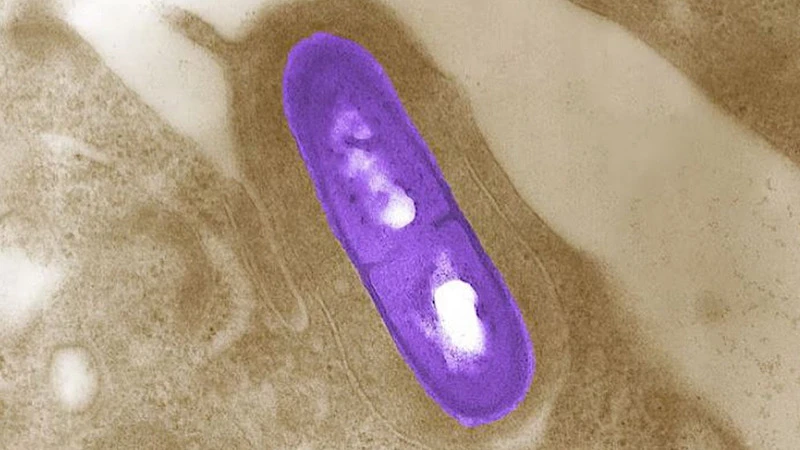 Vi khuẩn Listeria. (Ảnh: Reuters/TTXVN)