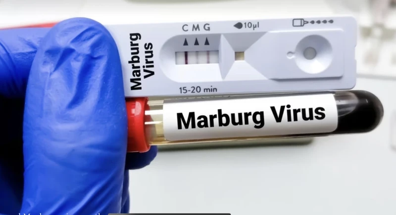 Ống xét nghiệm virus Marburg. Ảnh: Tân Hoa xã