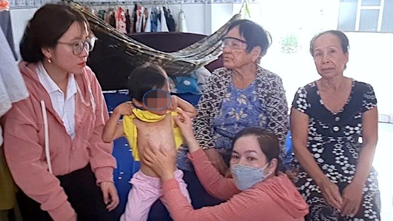 Lực lượng chức năng huyện Đầm Dơi (tỉnh Cà Mau) kiểm tra vết thương trên cơ thể cháu bé có dấu hiệu bị bạo hành.