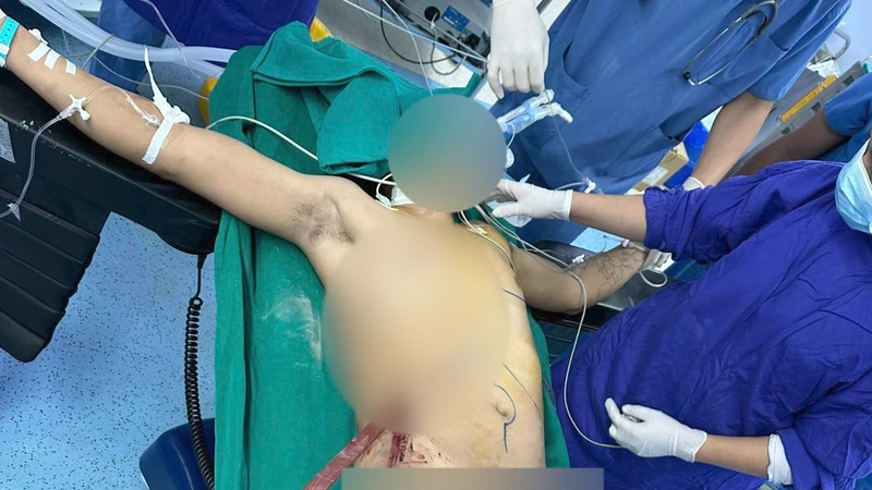 Nam thanh niên với vết thương thấu bụng-ngực do tai nạn lao động.