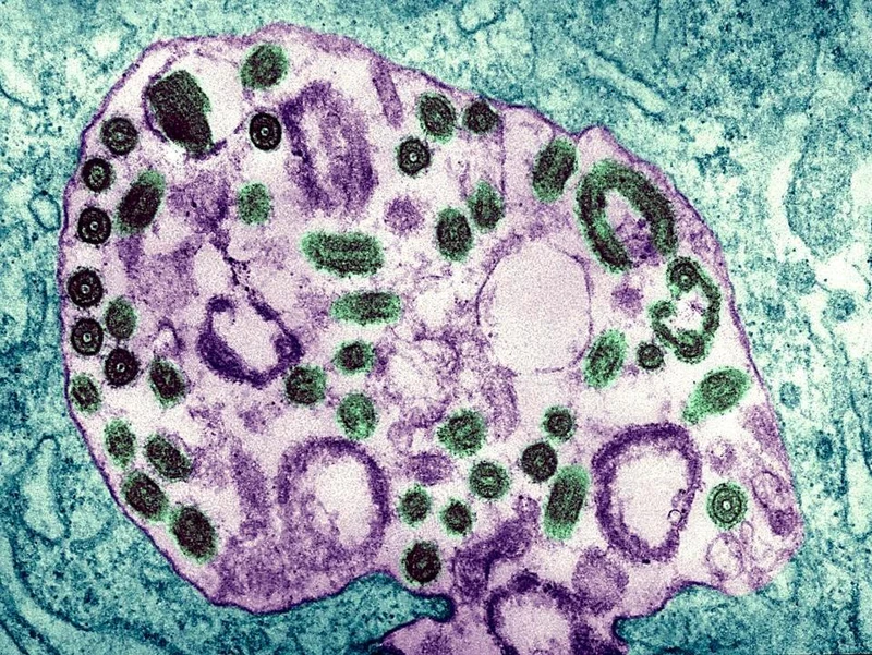 Hình ảnh dưới kính hiển vi điện tử của virus Marburg. (Ảnh: BSIP/UIG/Getty Images)