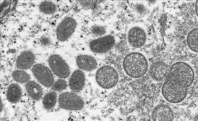 Hình ảnh dưới kính hiển vi cho thấy virus đậu mùa khỉ trong mẫu bệnh phẩm của 1 bệnh nhân. (Ảnh minh họa: Reuters/TTXVN)
