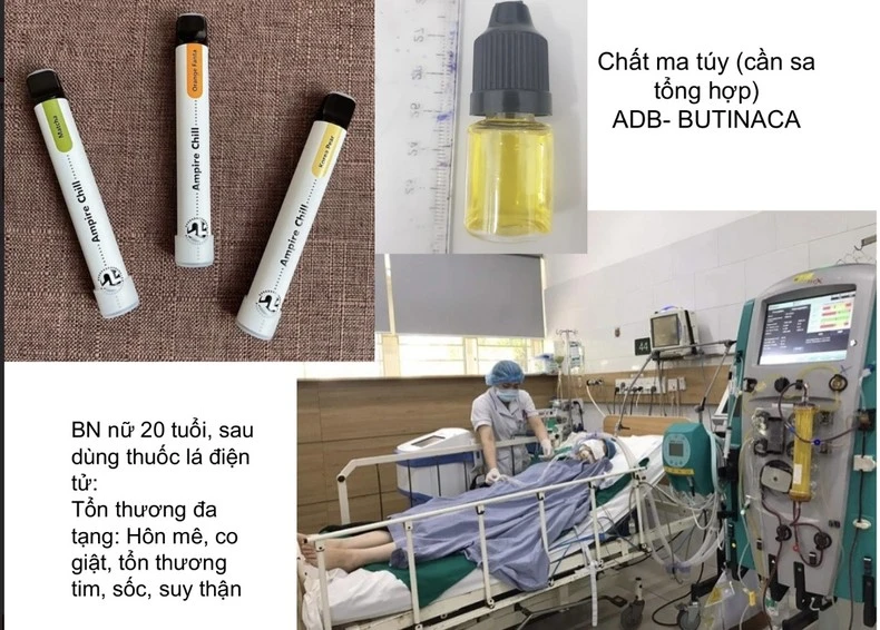 Một bệnh nhân cấp cứu tại Trung tâm chống độc sau khi dùng thuốc lá điện tử có chất ma túy.