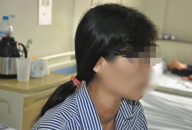 Bệnh nhân đang được điều trị tại Bệnh viện Nội tiết Trung ương.