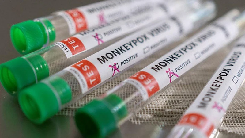 Ống đựng mẫu bệnh phẩm có đánh dấu dương tính với virus gây đậu mùa khỉ. (Ảnh: Reuters)
