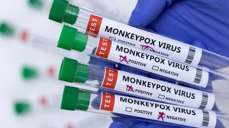 Ống đựng mẫu bệnh phẩm dương tính với virus gây bệnh đậu mùa khỉ. (Ảnh: Reuters)