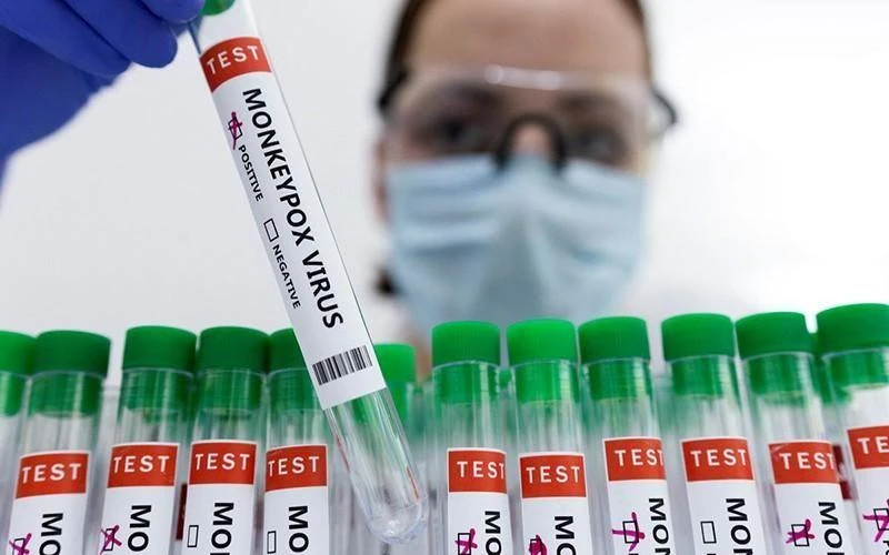 Ống đựng mẫu bệnh phẩm dương tính với virus gây bệnh đậu mùa khỉ. (Ảnh: Reuters)