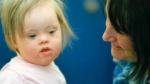 Công trình nghiên cứu là một “bước đột phá” cho trẻ mắc Hội chứng Down. (nguồn: BBC)