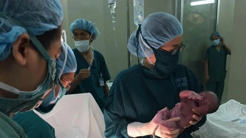 Các bác sĩ Bệnh viện Từ Dũ bắt em bé ra khỏi bụng mẹ.