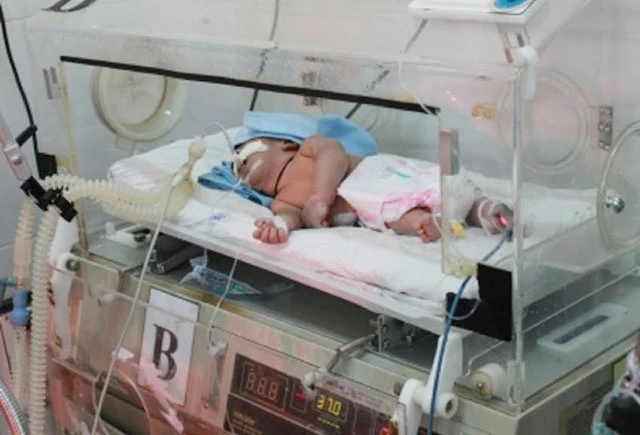 Một trẻ sơ sinh bị nhiễm uốn ván do các bà đỡ dùng dao lam cắt rốn sau khi sinh tại nhà đang được điều trị tại Bệnh viện Đa khoa tỉnh Đác Lắc.