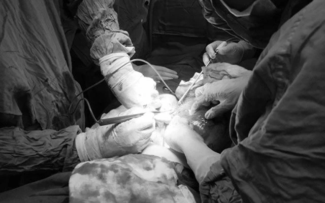 Ê-kíp phẫu thuật cắt bỏ khối u cho bệnh nhân T.T.K.L.