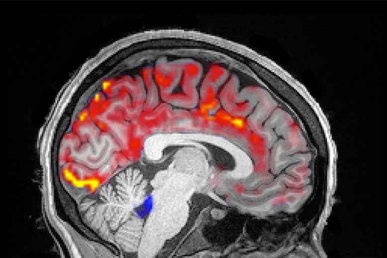 Oxy máu trong não (màu đỏ) khi ngủ.