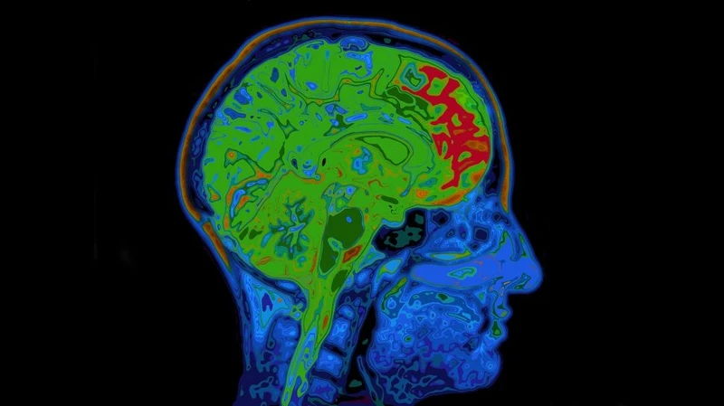 Não của bạn tiêu thụ bao nhiêu calo?