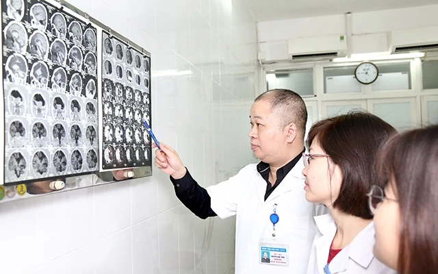 Bác sĩ Khoa Nội - Hồi sức thần kinh (Bệnh viện Hữu nghị Việt Ðức) đánh giá tổn thương của những người bị đột quỵ não.