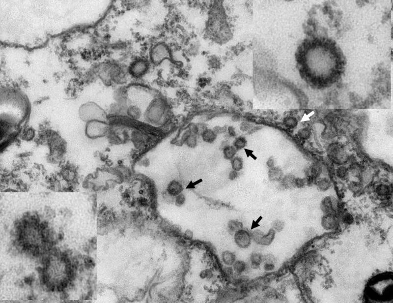 Cấu trúc virus corona điển hình tồn tại trong tê tê dưới kính hiển vi điện tử (Ảnh: ChinaDaily)