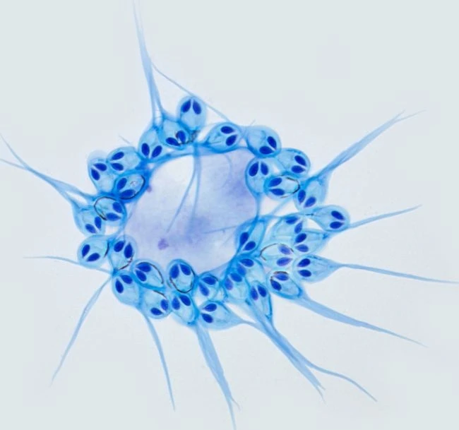 Các bào tử của ký sinh trùng H. salminicola bơi dưới kính hiển vi.