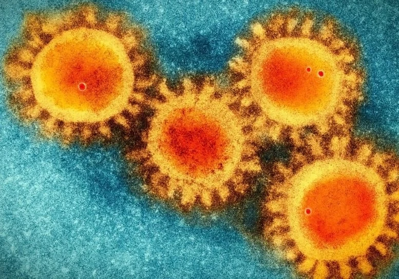 Virus corona chủng mới dưới kính hiển vi điện tử.