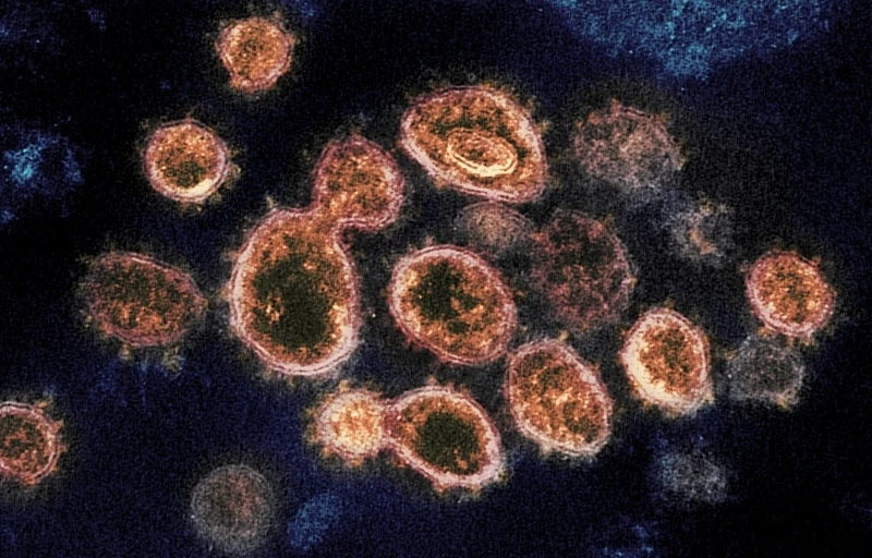 Virus gây ra Covid-19, được gọi là SARS-CoV-2 dưới kính hiển vi điện tử.