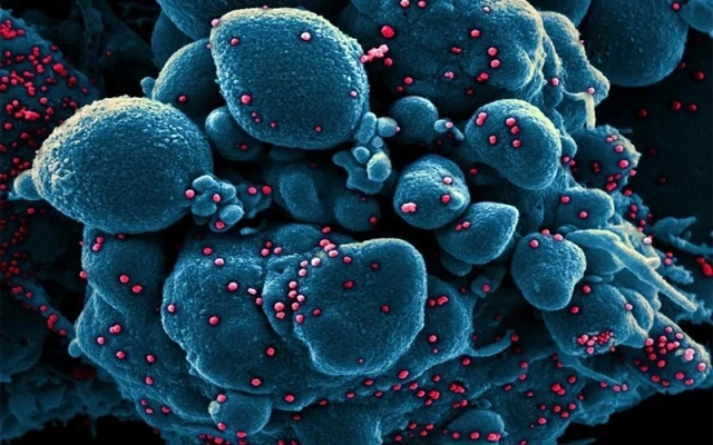 Ảnh vi điện tử của một tế bào apoptotic (màu xanh) bị nhiễm các hạt virus SARS-COV-2 (màu đỏ), được phân lập từ mẫu bệnh nhân. Ảnh: REUTERS/NIAID-IRF.