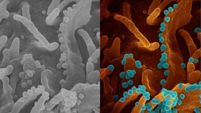 Hình ảnh virus SARS-CoV-2 giải phóng từ một tế bào sắp chết
